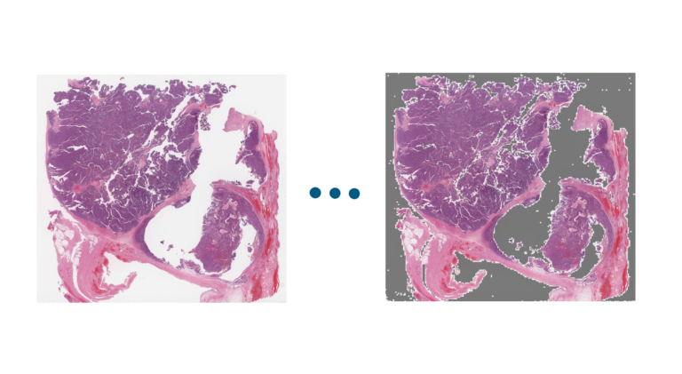 TissueFinder comparison showing a histological slide before and after removal of non-tissue image areas