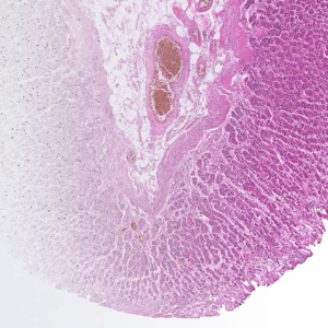 AI-generated virtual staining of a tissue section