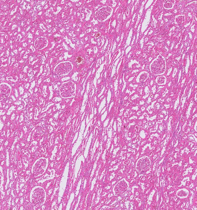 Conventionally stained renal tissue section in digital pathology
