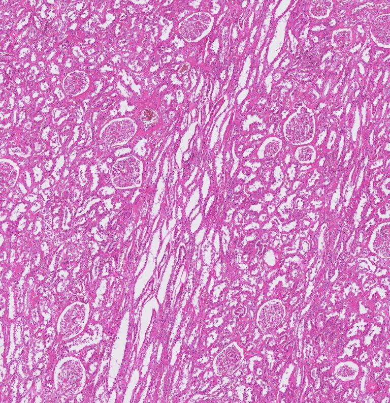 AI-generated virtual staining of a renal tissue section
